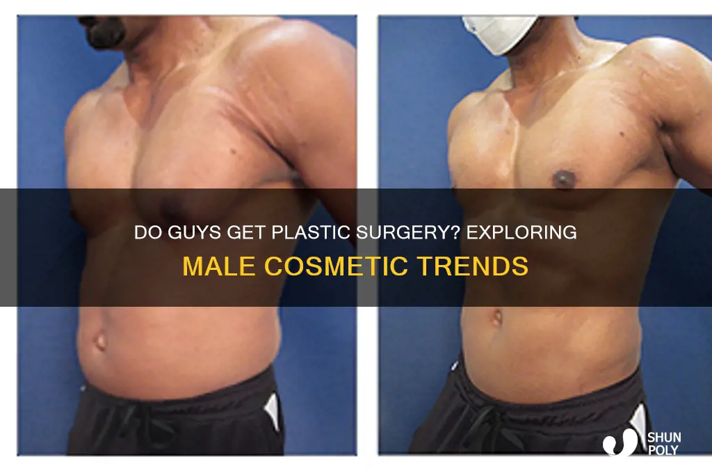 do guys get plastic surgery