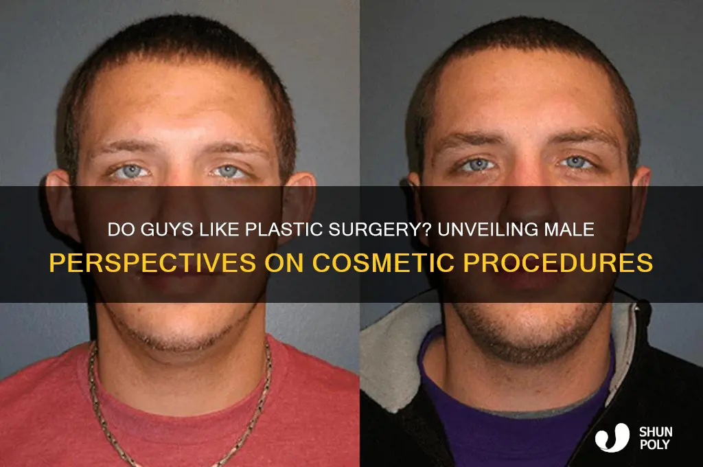 do guys like plastic surgery