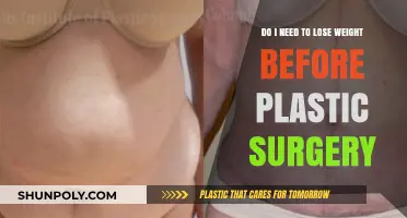 Should You Lose Weight Before Plastic Surgery? Expert Insights