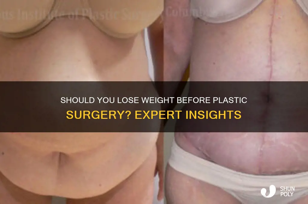 do i need to lose weight before plastic surgery