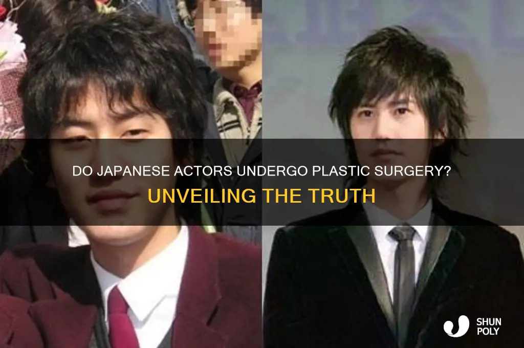 do japanese actors get plastic surgery