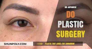 Exploring the Popularity of Plastic Surgery in Japan: Trends and Insights