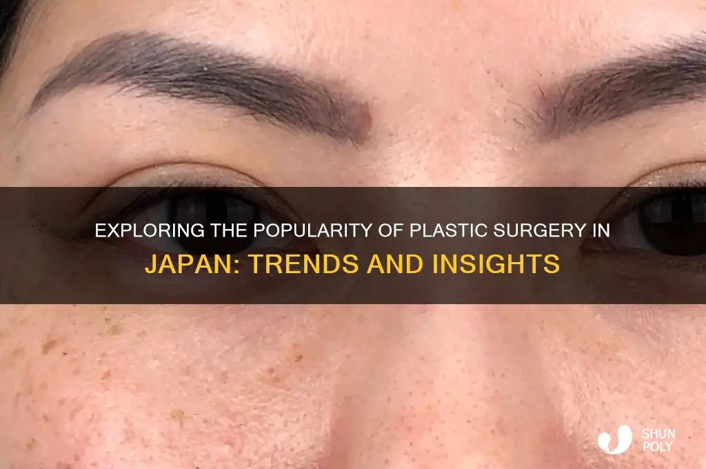 do japanese do plastic surgery