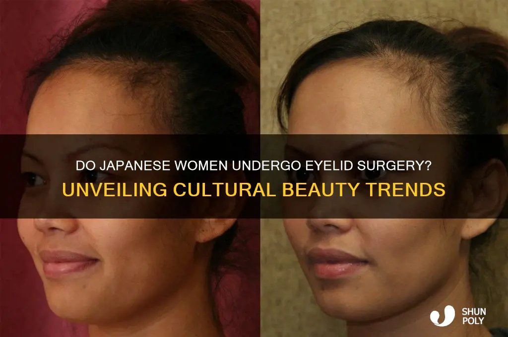 do japanese girls get plastic surgery on eyes