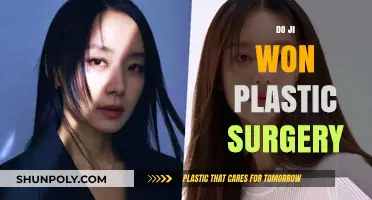 Do Ji Won Plastic Surgery: Unveiling the Truth Behind Her Transformation
