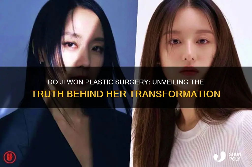 do ji won plastic surgery