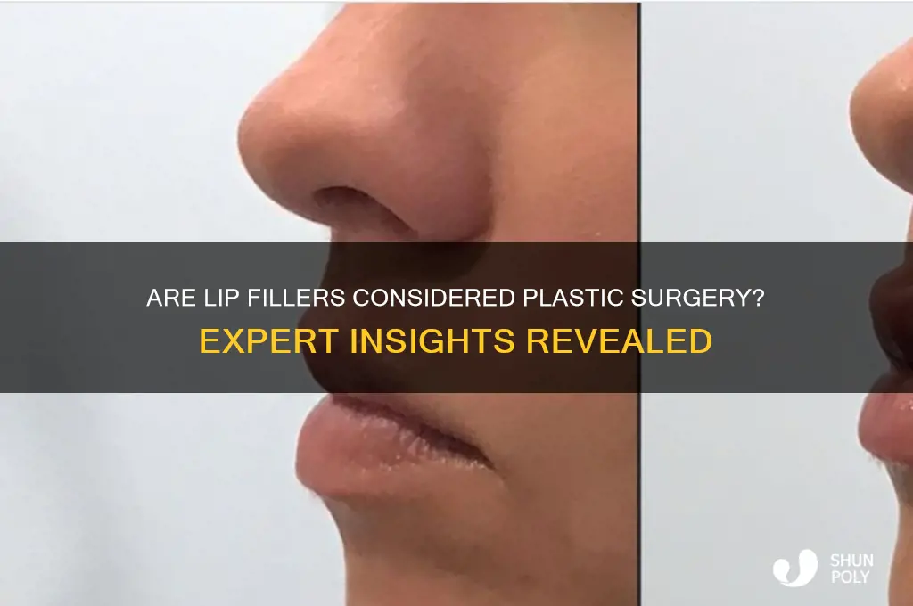 do lip fillers count as plastic surgery