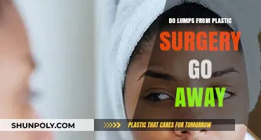Do Post-Plastic Surgery Lumps Dissolve Over Time? Expert Insights
