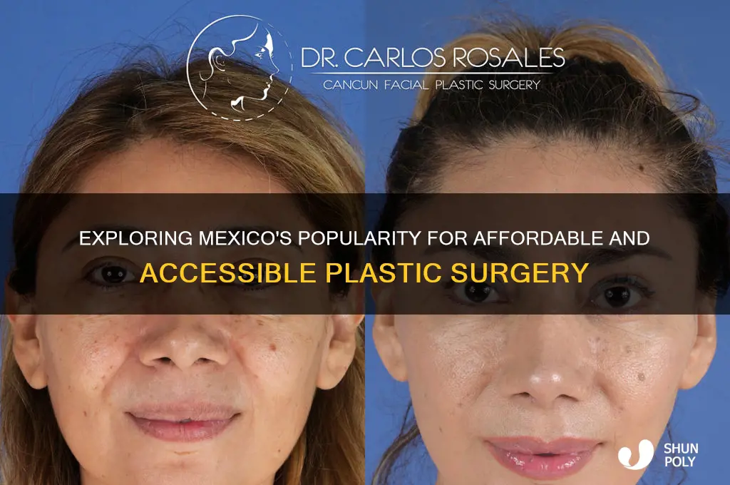 do many people get plastic surgery in mexico