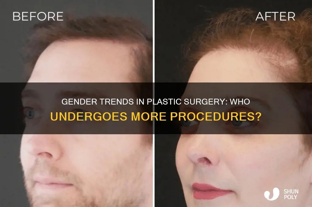 do men or women get more plastic surgery