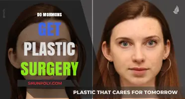 Mormon Beauty Standards: Exploring Plastic Surgery Trends and Beliefs