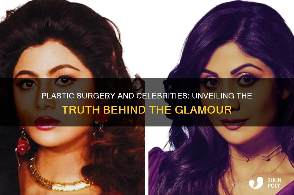 do most celebrites have plastic surgery
