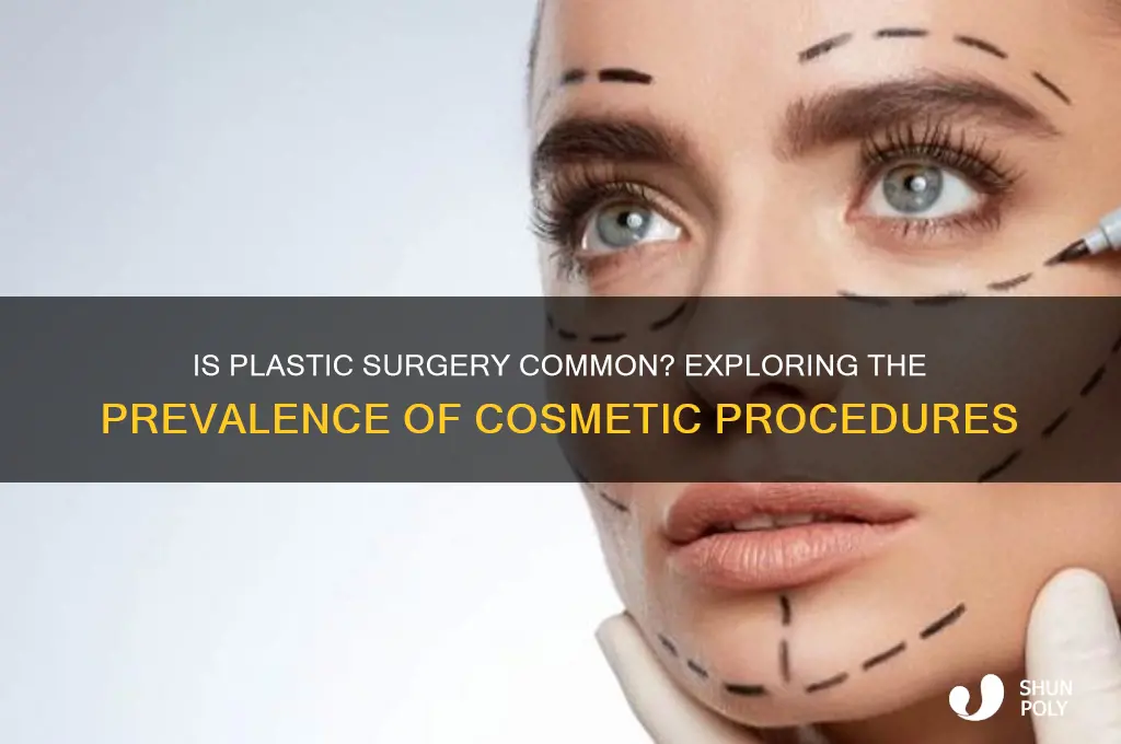 do most people get plastic surgery