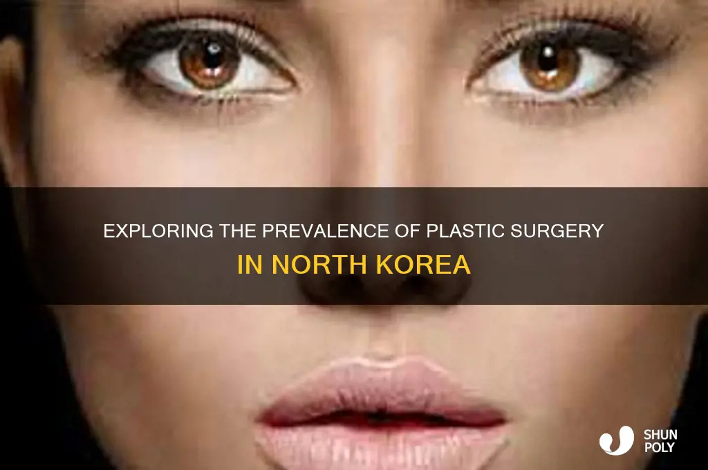 do north koraens have plastic surgery
