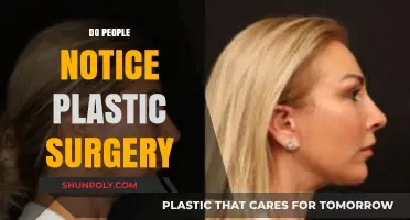 Do People Notice Plastic Surgery? Unveiling the Truth Behind the Transformation