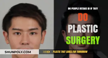 Plastic Surgery and ID Renewal: Do You Need to Retake Photos?