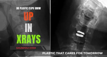 Plastic Clips: X-Ray Vision