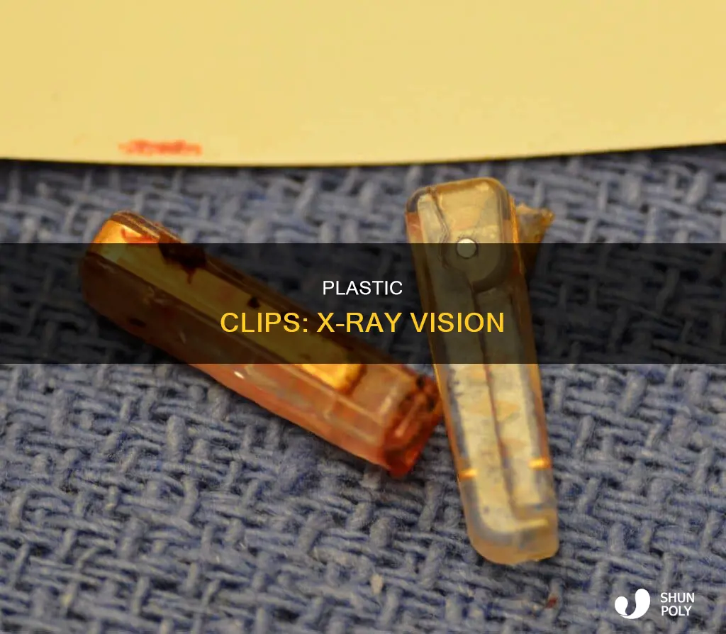 do plastic clips show up in xrays