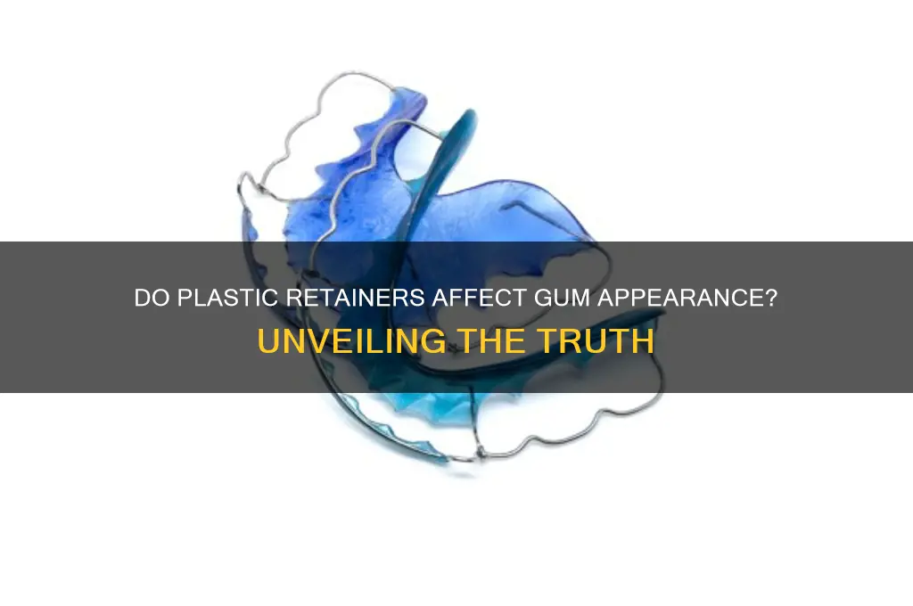 do plastic retainers make the gums look weired