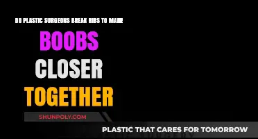 Do Plastic Surgeons Break Ribs for Closer Breasts? Facts Revealed