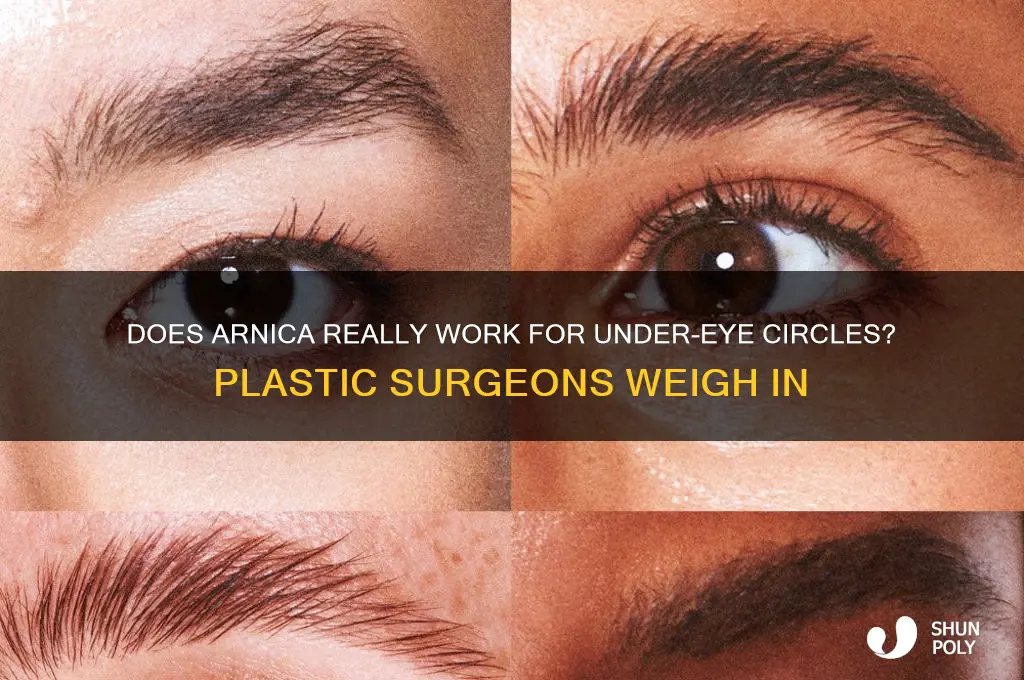 do plastic surgeons claim arnica works for undereye crcles