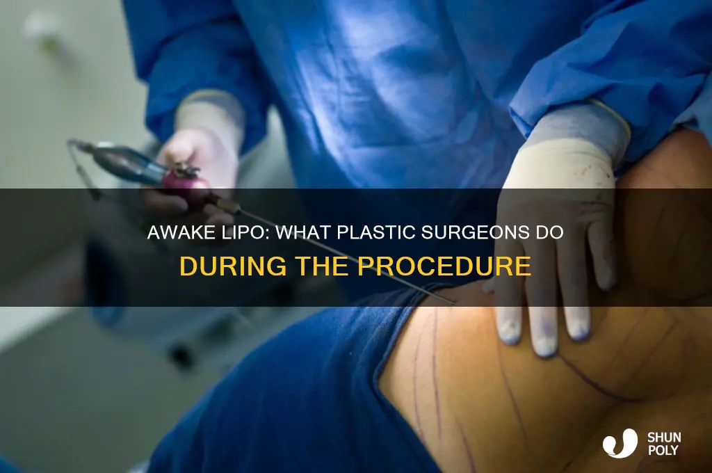 do plastic surgeons do awake lipo
