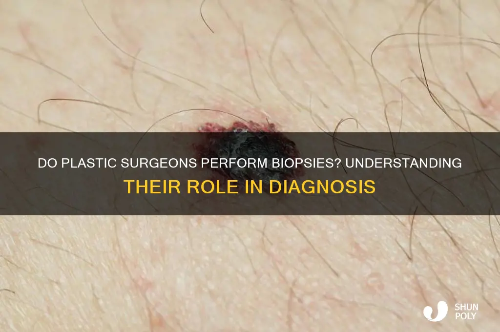 do plastic surgeons do biopsies