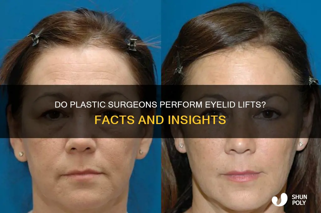 do plastic surgeons do eye lid lifts