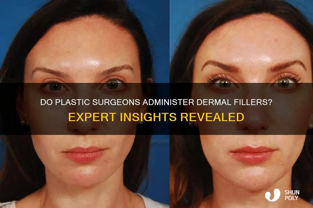do plastic surgeons do fillers