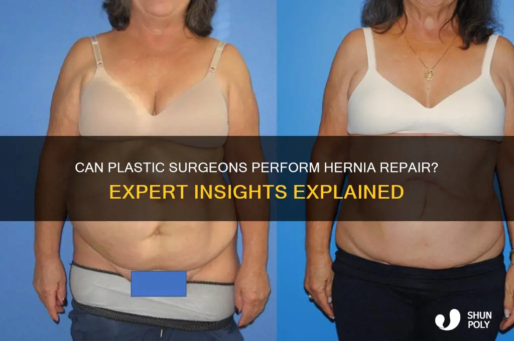 do plastic surgeons do hernia repair