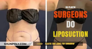 Do Plastic Surgeons Perform Liposuction? Exploring the Role and Procedures