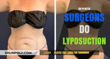 Do Plastic Surgeons Perform Liposuction? Understanding Their Role and Expertise