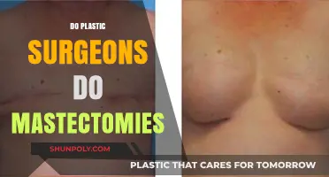 Do Plastic Surgeons Perform Mastectomies? Understanding Surgical Roles and Expertise