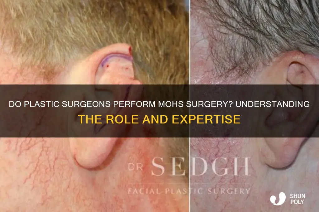 do plastic surgeons do mohs surgery