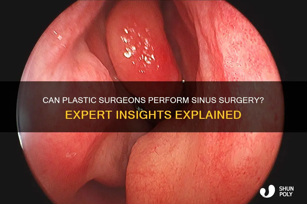 do plastic surgeons do sinus surgery