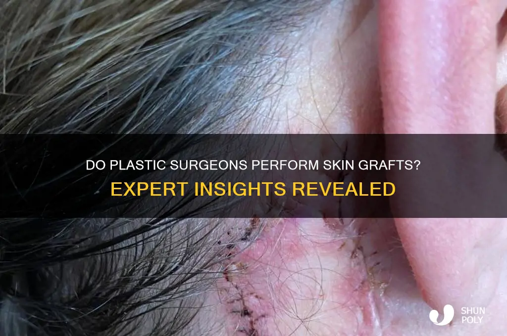 do plastic surgeons do skin grafts