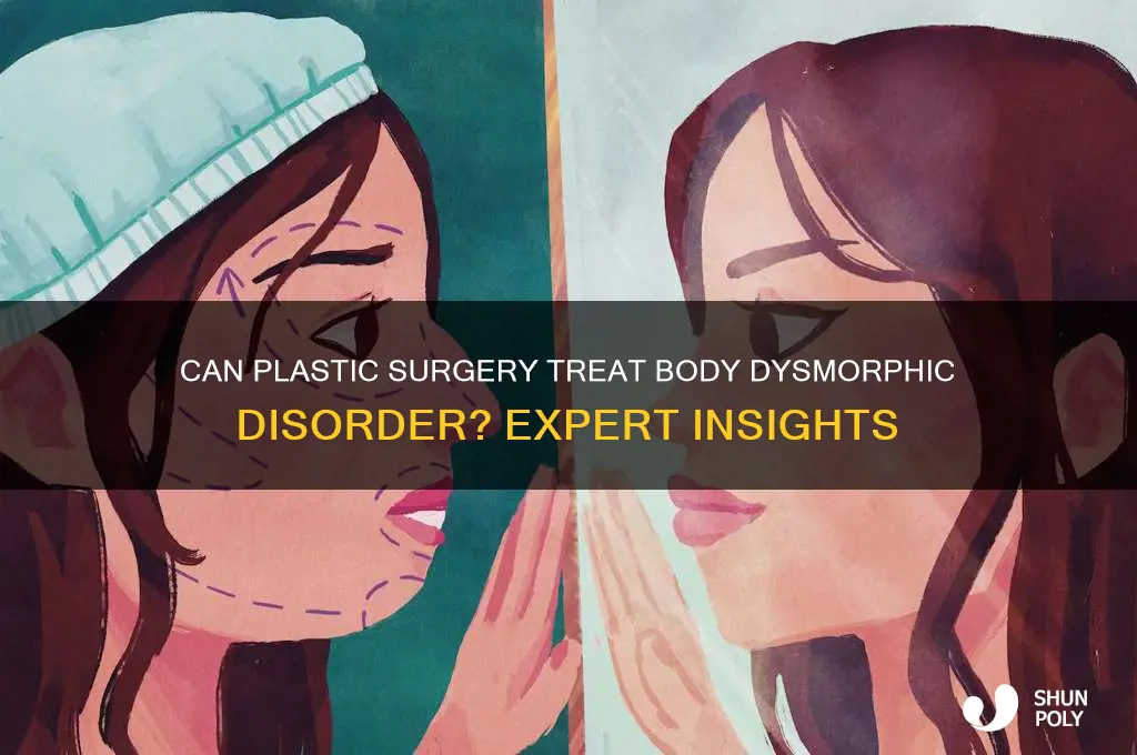 do plastic surgeons fix body dismorphic disorder