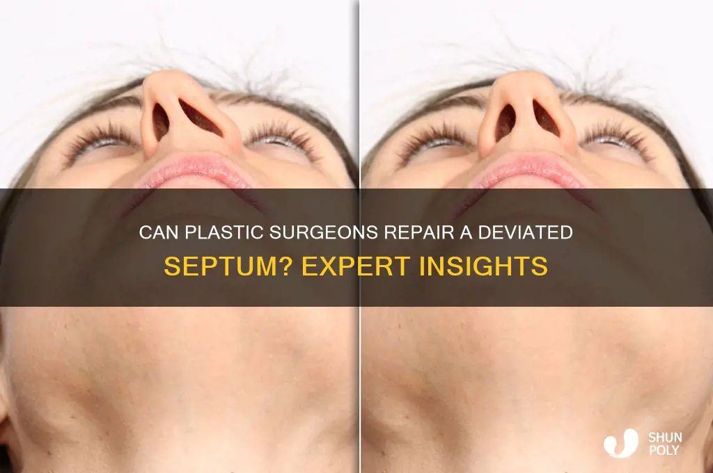 do plastic surgeons fix deviated septum