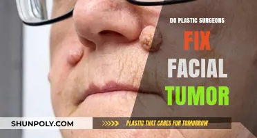 Can Plastic Surgeons Remove Facial Tumors? Expert Insights and Procedures