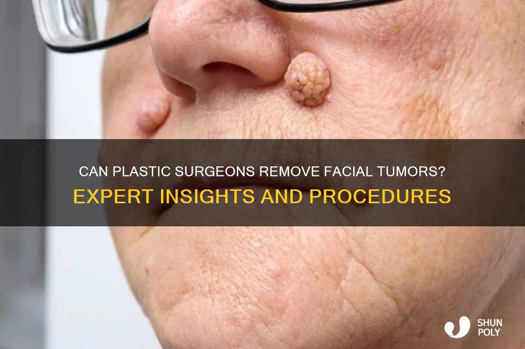 do plastic surgeons fix facial tumor