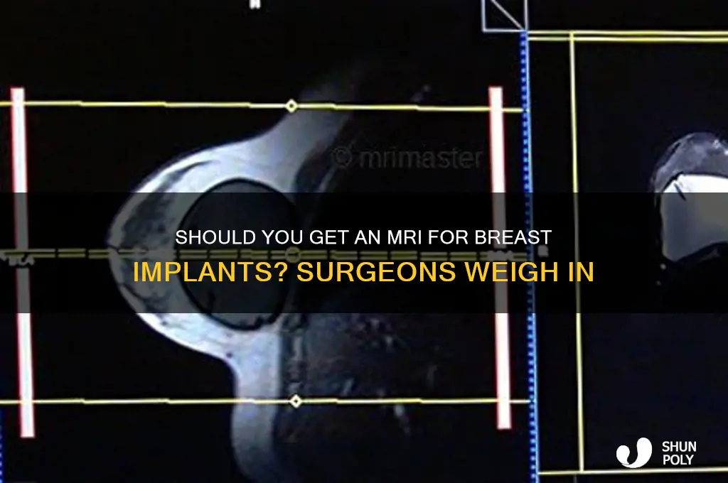 do plastic surgeons recommend mri for breast implants