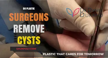 Can Plastic Surgeons Remove Cysts? Expert Insights and Procedures