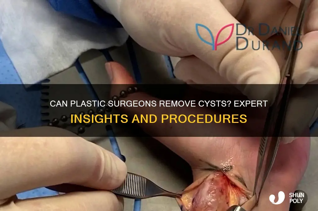 do plastic surgeons remove cysts