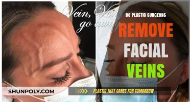 Can Plastic Surgeons Remove Facial Veins? Expert Insights Revealed