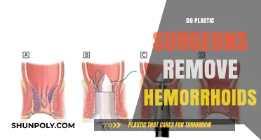 Can Plastic Surgeons Treat Hemorrhoids? Surprising Facts Revealed