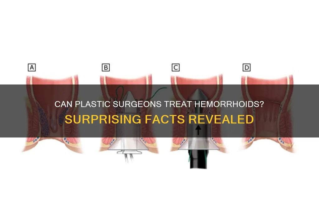 do plastic surgeons remove hemorrhoids