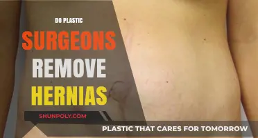 Plastic Surgeons and Hernias: Understanding Surgical Roles and Procedures