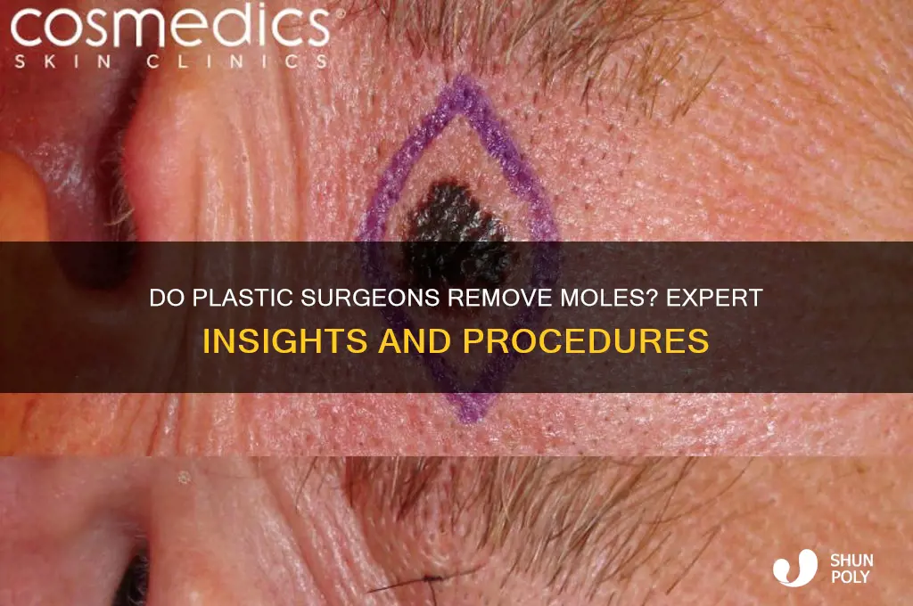 do plastic surgeons remove moles