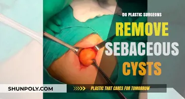 Can Plastic Surgeons Remove Sebaceous Cysts? Expert Insights Revealed