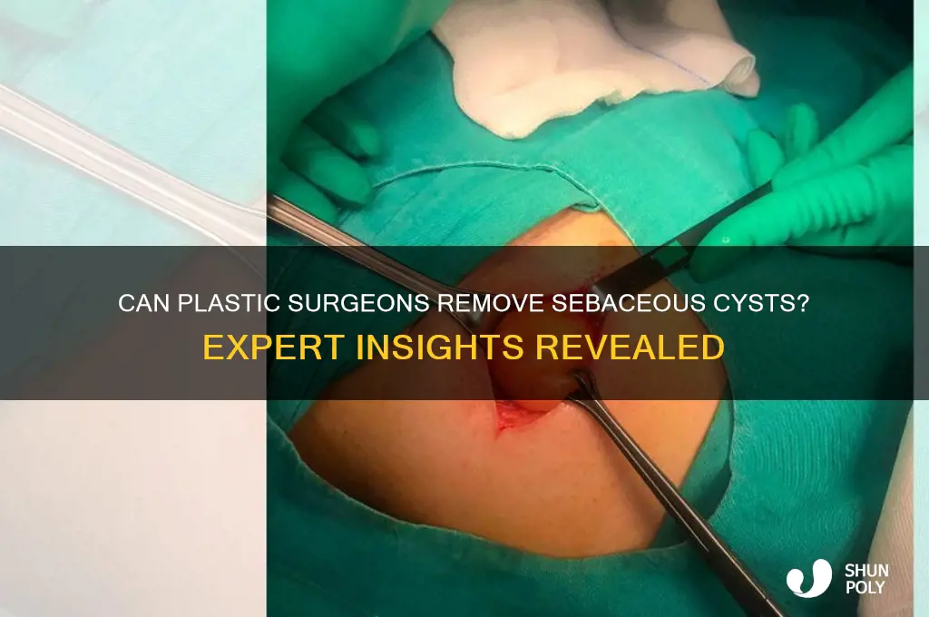 do plastic surgeons remove sebaceous cysts